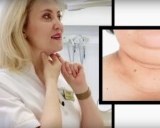 owal twarzy / YouTube: Estetyka i Chirurgia