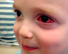 Dziecko. Źródło: Youtube paulthomasmd