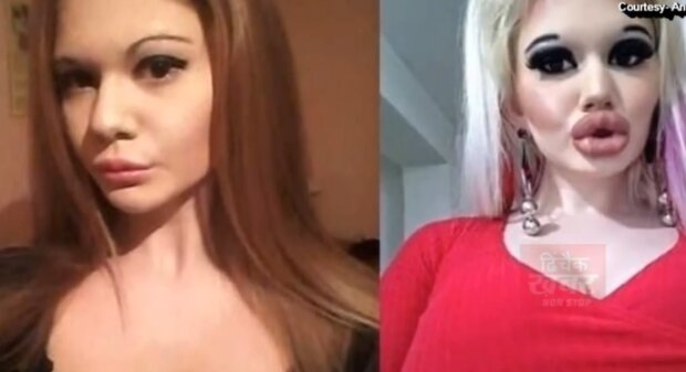 Andrea Ivanovna przed i po zabiegach/YouTube @Dhinchak khabare