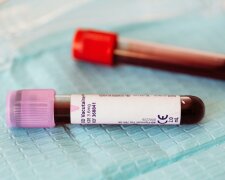 Charakter zapisany we krwi. Oto, co twoja grupa krwi mówi o tobie