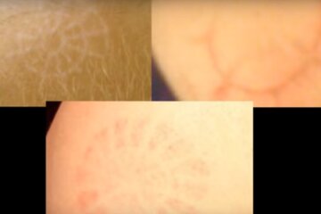 ślady na skórze / YouTube: Zjawiska Niewyjaśnione
