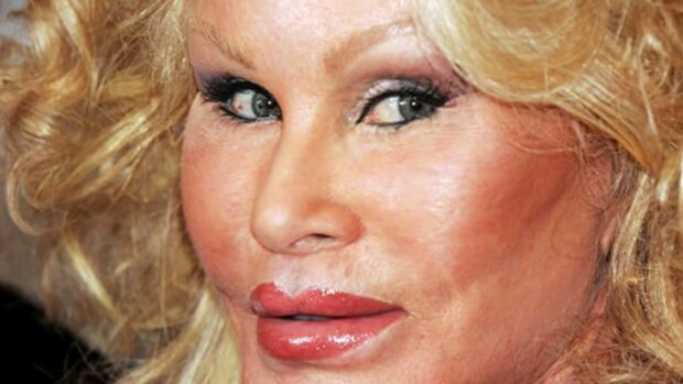 Jocelyn Wildenstein, screen Youtube @Top10BeyondTheScreen