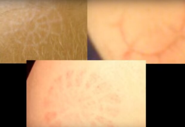 ślady na skórze / YouTube: Zjawiska Niewyjaśnione