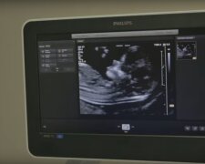 badanie USG / YouTube: Philips Polska