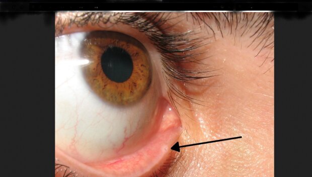 Punkty łzowe/ Reddit @garfieldfanaccount